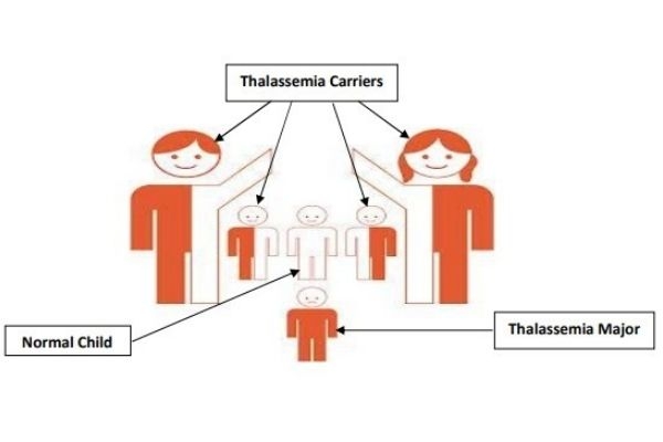 Thalassemia
